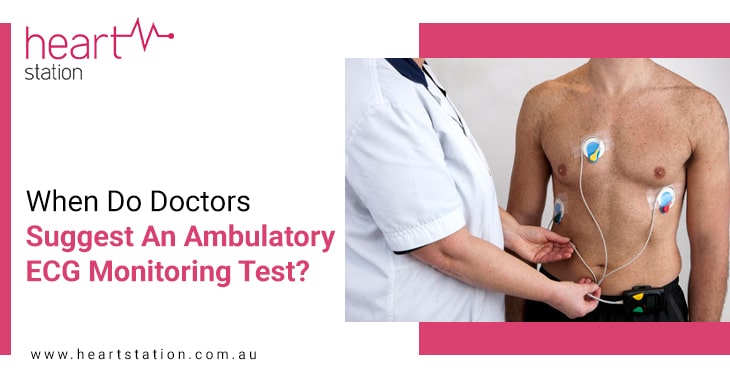 When Do Doctors Suggest An Ambulatory ECG Monitoring Test?