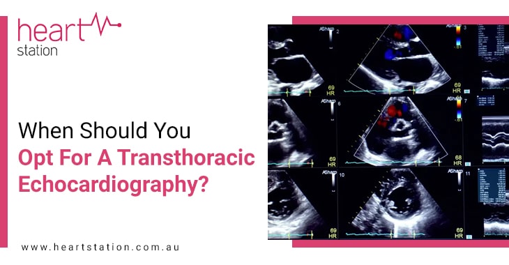 When Should You Opt For A Transthoracic Echocardiography?