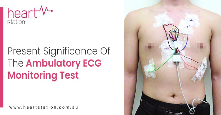 Present Significance Of The Ambulatory ECG Monitoring Test
