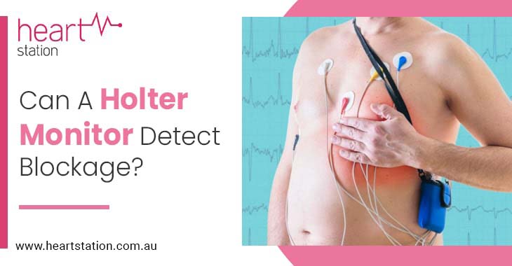 Can A Holter Monitor Detect Blockage?