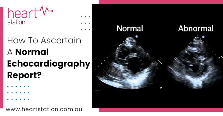 How To Ascertain A Normal Echocardiography Report?